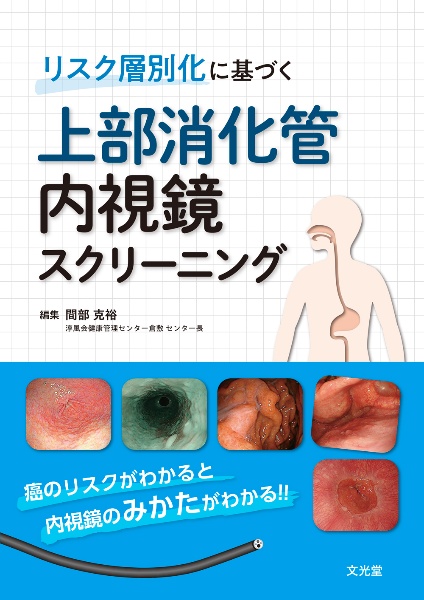 リスク層別化に基づく　上部消化管内視鏡スクリーニング