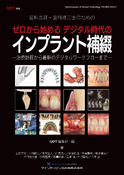 インプラント周囲炎の科学と臨床 Quintessence DENTAL