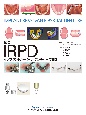 最新IRPD　インプラントパーシャルデンチャーの実践