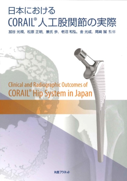 日本におけるCORAIL(R)人工股関節の実際