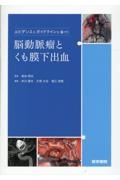 エビデンスとガイドラインに基づく脳動脈瘤とくも膜下出血/森田明夫