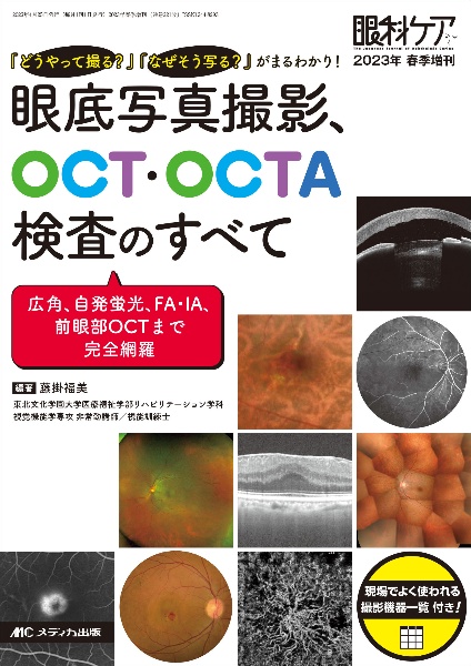 眼底写真撮影、ＯＣＴ・ＯＣＴＡ検査のすべて　「どうやって撮る？」「なぜそう写る？」がまるわかり