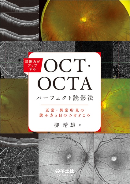 診断力がアップする！ＯＣＴ・ＯＣＴＡパーフェクト読影法