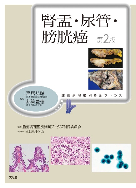 精巣腫瘍病理アトラス 裁断済み 病理診断の現場から】形態学診断医の あれ！この症例～去勢後に発生
