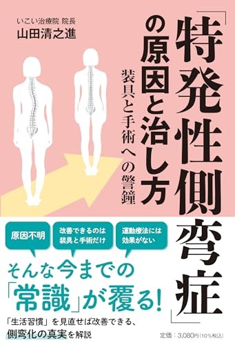 「特発性側弯症」の原因と治し方　装具と手術への警鐘