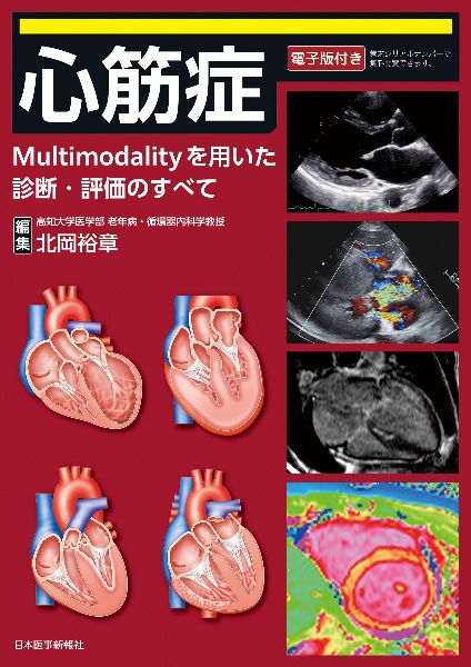 心筋症　Ｍｕｌｔｉｍｏｄａｌｉｔｙを用いた診断・評価のすべて