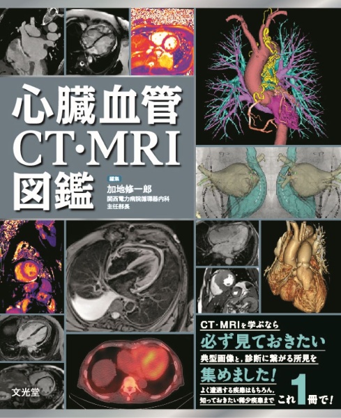 心臓血管ＣＴ・ＭＲＩ図鑑