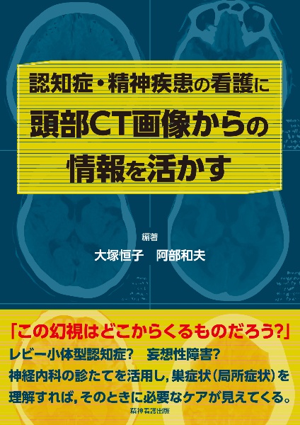 認知症・精神疾患の看護に頭部ＣＴ画像からの情報を活かす