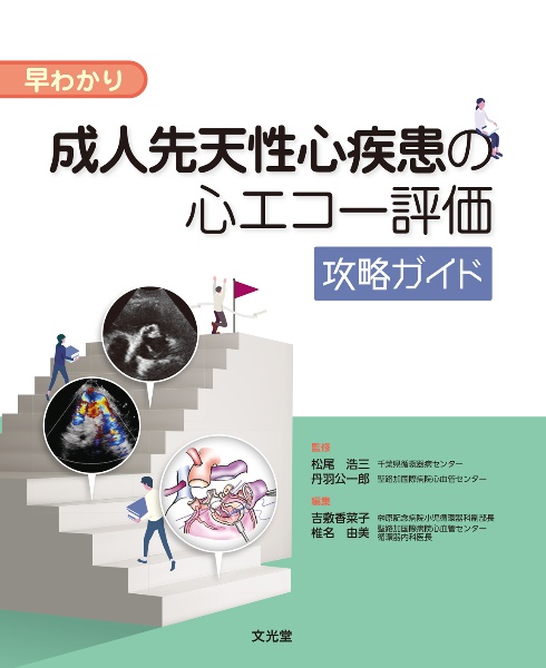 早わかり　成人先天性心疾患の心エコー評価攻略ガイド