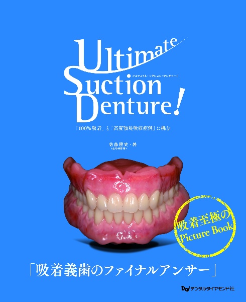 Ｕｌｔｉｍａｔｅ　Ｓｕｃｔｉｏｎ　Ｄｅｎｔｕｒｅ　！　「１００％吸着」と「高度顎堤吸収症例」に挑む