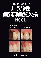 非う蝕性歯頚部歯質欠損　NCCL　なぜ起きる？どう対応する？