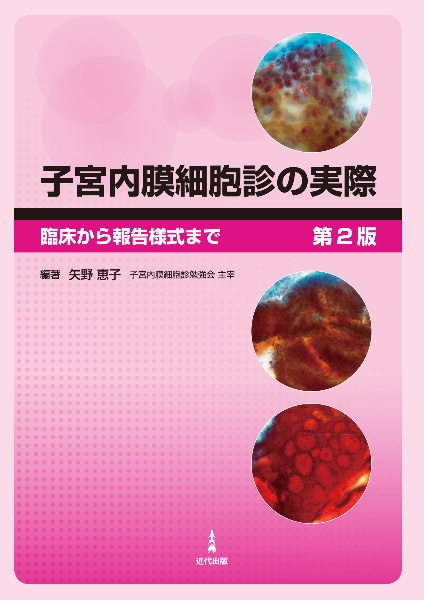 子宮内膜細胞診の実際　臨床から報告様式まで　第２版