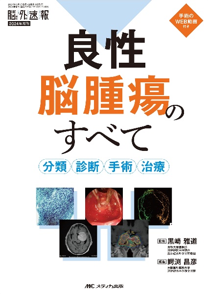 良性脳腫瘍のすべて　分類・診断・手術・治療