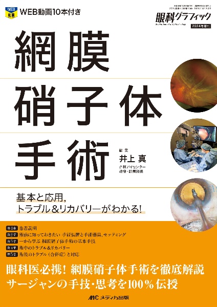 網膜硝子体手術　基本と応用，トラブル＆リカバリーがわかる！