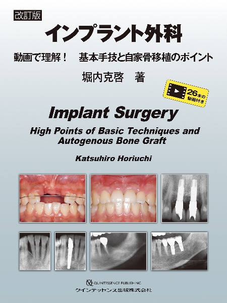 改訂版　インプラント外科　動画で理解！　基本手技と自家骨移植のポイント