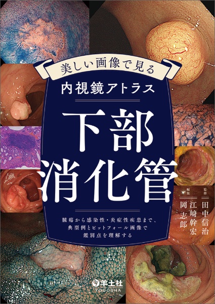 美しい画像で見る内視鏡アトラス　下部消化管