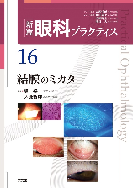 眼科グラフィック 特集:そこが知りたい!スリットランプ上達のコツと技