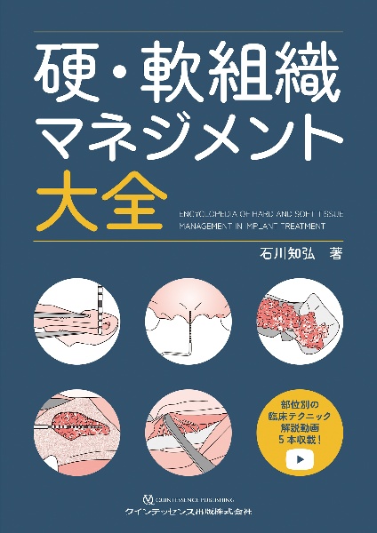 5ーDコンセンサス 歯の保存にこだわる これまでの軌跡と次世代への