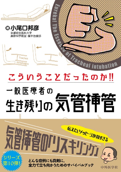 こういうことだったのか!! 一般医療者の生き残りの気管挿管