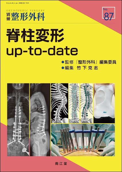脊柱変形 upーtoーdate/竹下克志 - 販売書籍｜TSUTAYA レンタル・販売