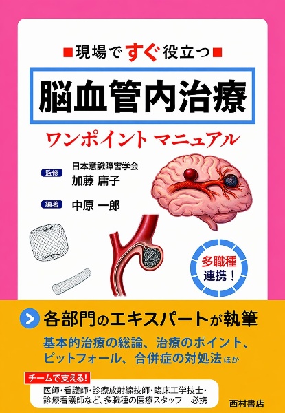 パーフェクトマスター 脳血管内治療 改訂第2版 メジカルビュー社｜脳神経外科｜パーフェクトマスター脳血管内治療